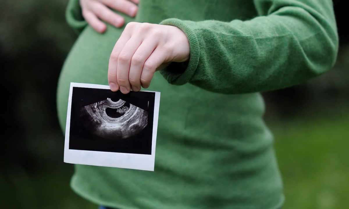 A pregnant woman showing an ultrasound photograph